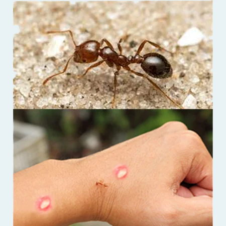 picadura hormigas rojas