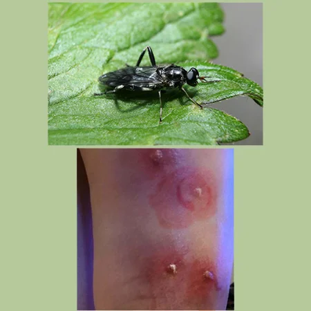 como es la picadura de la mosca negra