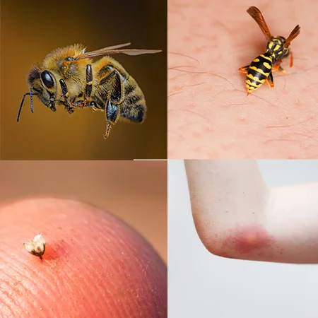 picaduras de abejas y avispas